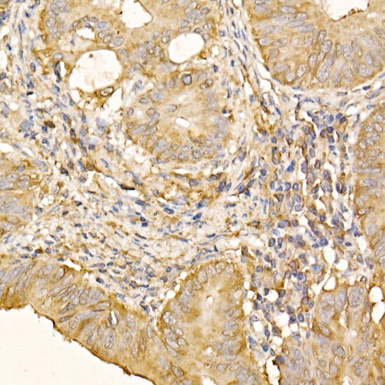 RPLP2 Antibody - BSA Free