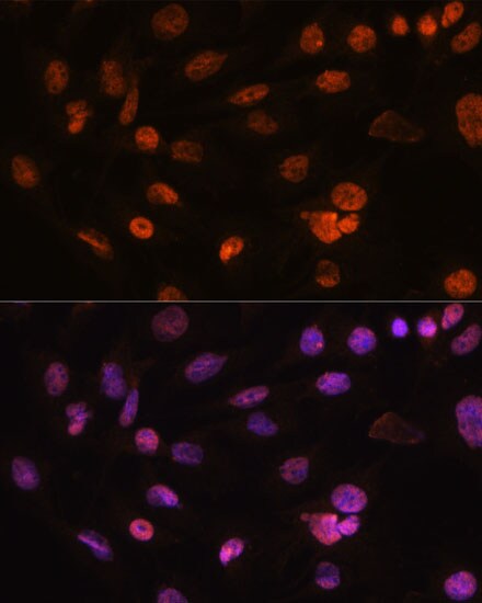 H2AFV Antibody - Azide and BSA Free