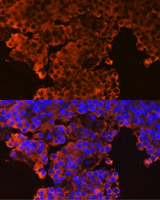 GHRHR Antibody - BSA Free