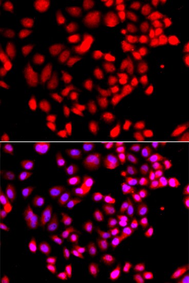 RPS6KL1 Antibody - Azide and BSA Free