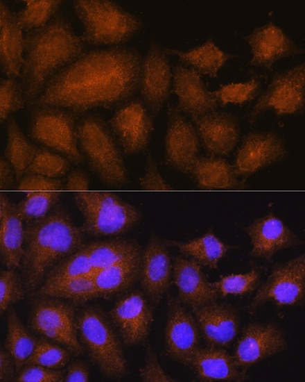 GSTT2B Antibody - Azide and BSA Free