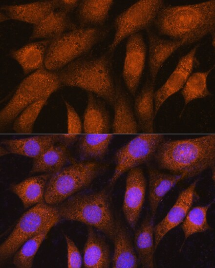 GSTT2B Antibody - Azide and BSA Free