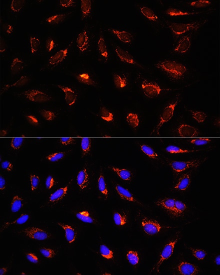 GCSH Antibody - Azide and BSA Free
