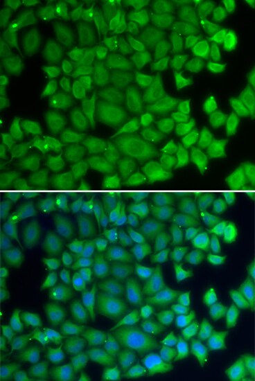 HspB2 Antibody - BSA Free