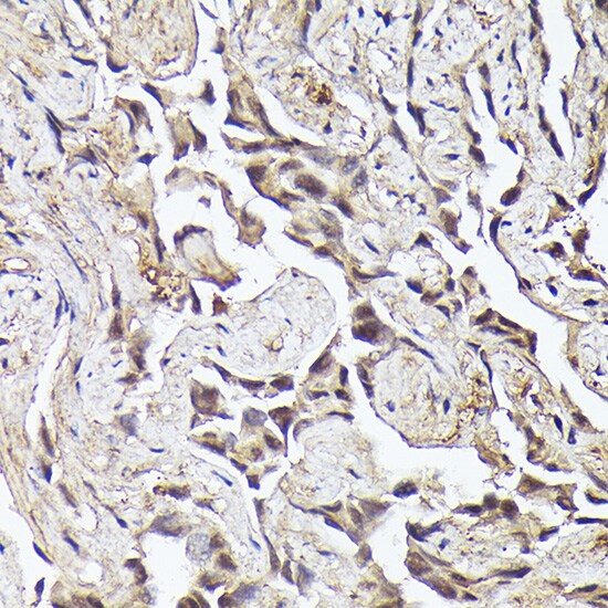 METTL4 Antibody - Azide and BSA Free