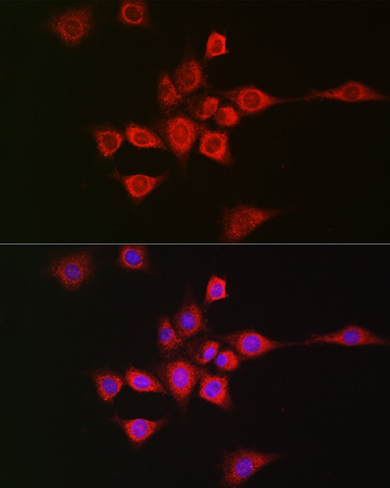 METTL4 Antibody - Azide and BSA Free