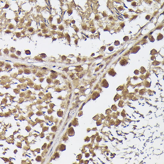 METTL4 Antibody - Azide and BSA Free