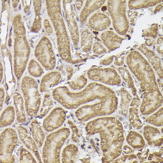 METTL4 Antibody - Azide and BSA Free