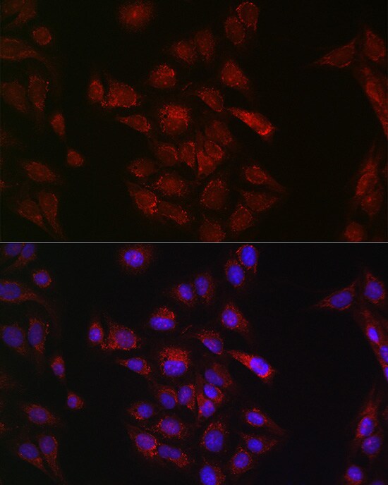 METTL4 Antibody - Azide and BSA Free