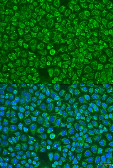 ARSF Antibody - BSA Free