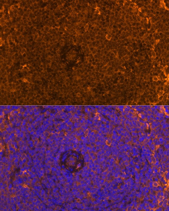 FAM65B Antibody - Azide and BSA Free