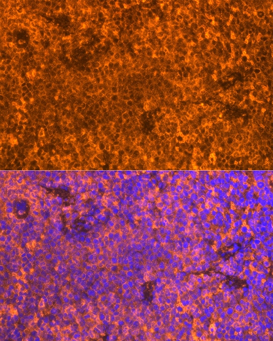 FAM65B Antibody - Azide and BSA Free