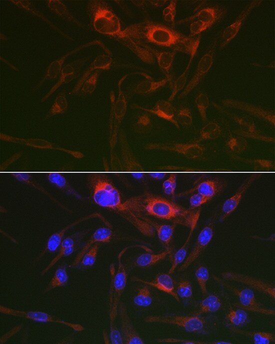 PRKAG3 Antibody - Azide and BSA Free