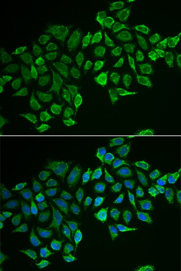 RhoD Antibody - Azide and BSA Free
