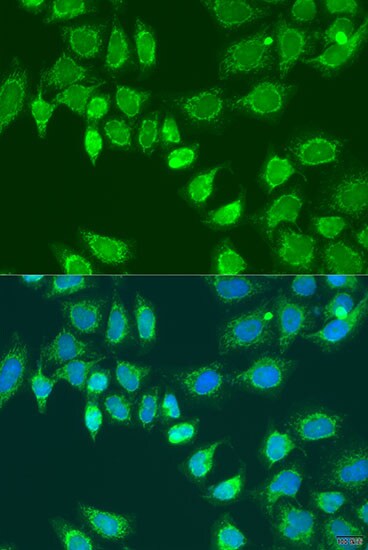 L2HGDH Antibody - BSA Free