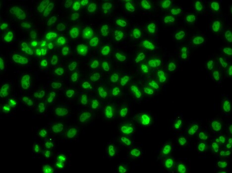 Lhx8 Antibody - BSA Free