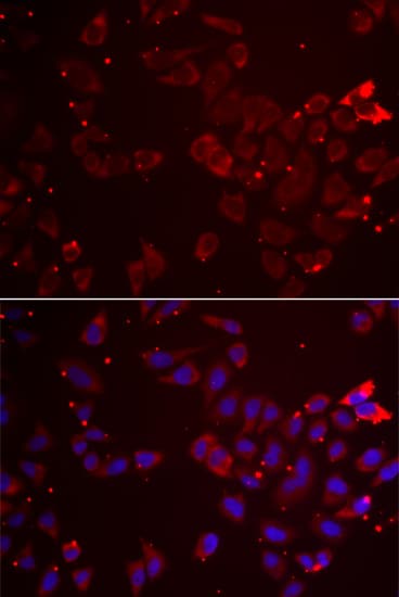 GATM Antibody - Azide and BSA Free