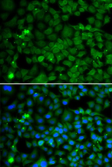 SMYD4 Antibody - Azide and BSA Free