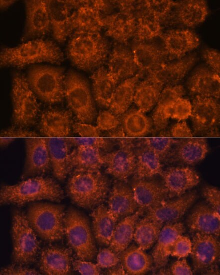 INMT Antibody - Azide and BSA Free