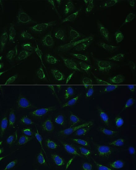 HCCS Antibody - BSA Free