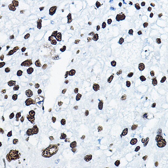 Mkl1 Antibody - BSA Free