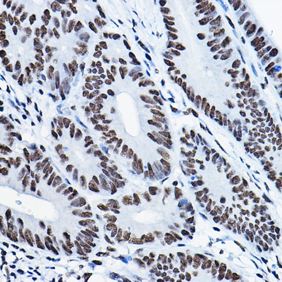 Mkl1 Antibody - BSA Free