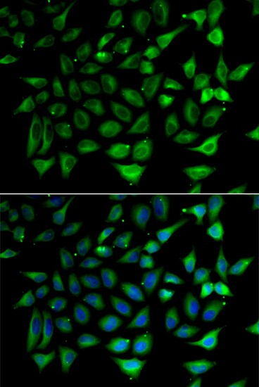 SLC25A20 Antibody - Azide and BSA Free