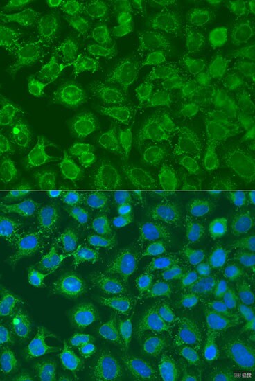 eIF2B1 Antibody - BSA Free