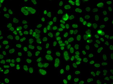 PLCXD2 Antibody - BSA Free