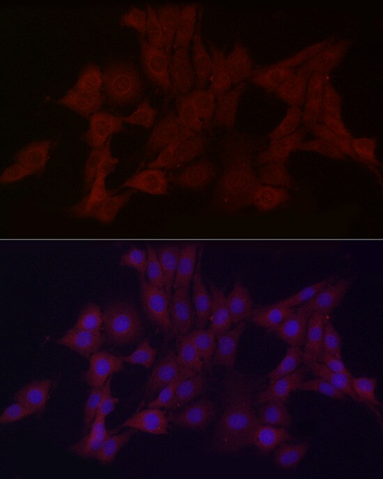 WDR45 Antibody - Azide and BSA Free