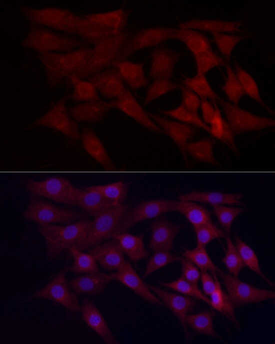 WDR45 Antibody - Azide and BSA Free