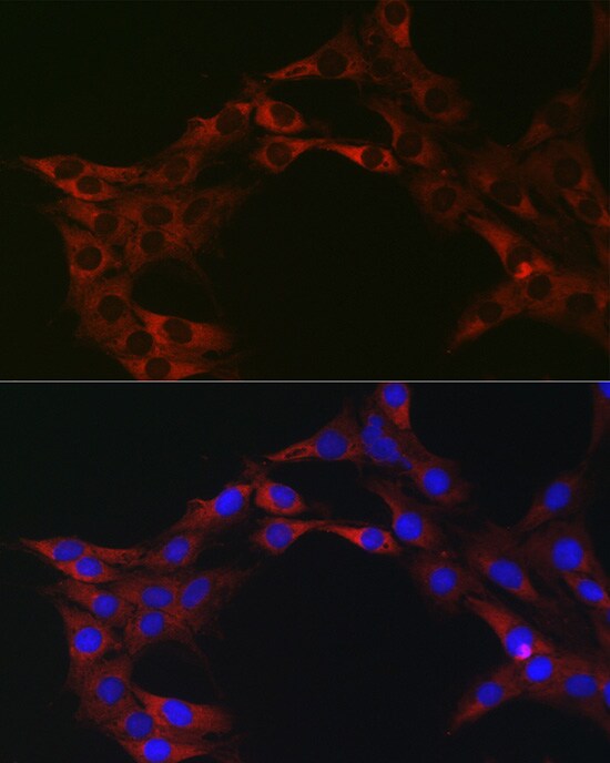 eIF4A1 Antibody - Azide and BSA Free