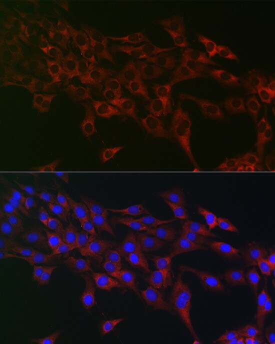 eIF4A1 Antibody - Azide and BSA Free