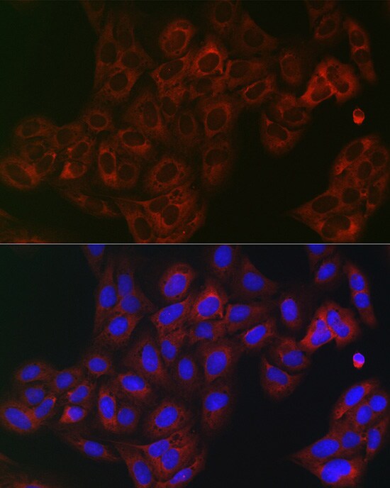 eIF4A1 Antibody - Azide and BSA Free