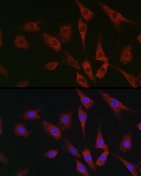 eIF4A1 Antibody - Azide and BSA Free