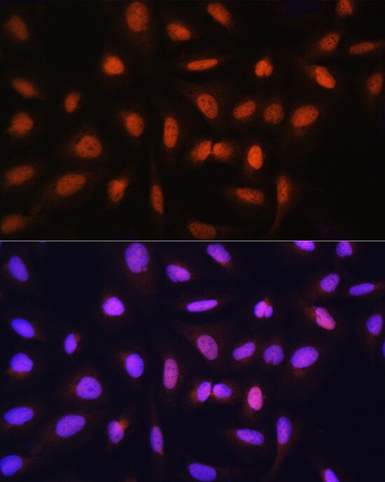 GTF2H1 Antibody - BSA Free