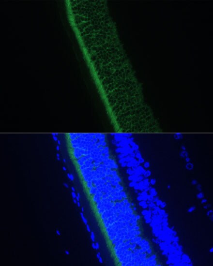 GNGT1 Antibody - Azide and BSA Free