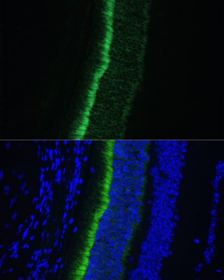 GNGT1 Antibody - Azide and BSA Free