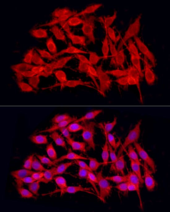 JMJD4 Antibody - BSA Free
