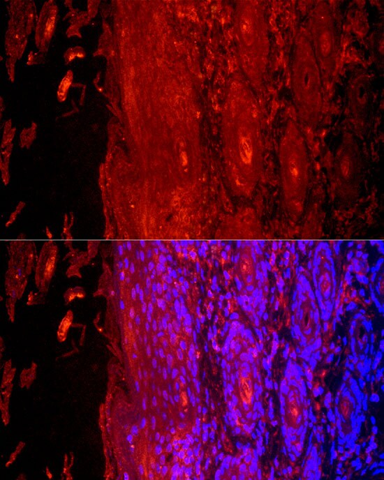 KRT9 Antibody - BSA Free