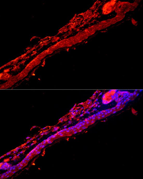 KRT9 Antibody - BSA Free