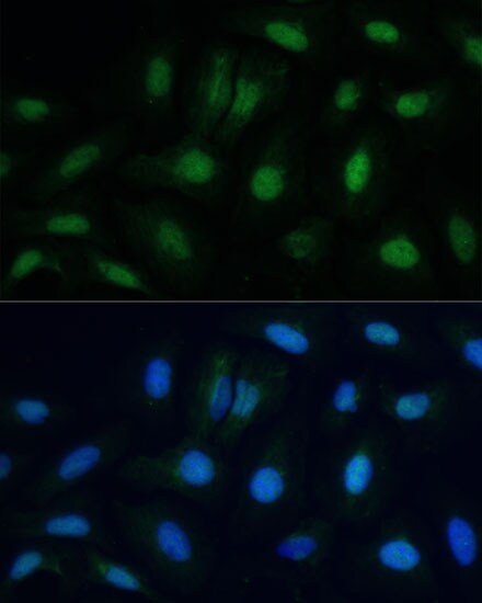 ETS2 Antibody - Azide and BSA Free