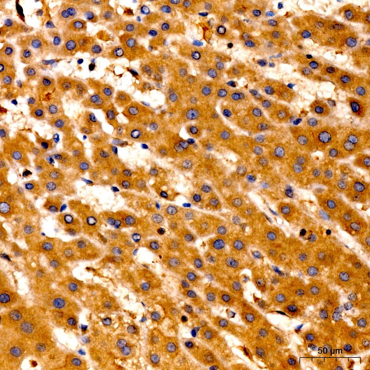 LPCAT3 Antibody - Azide and BSA Free