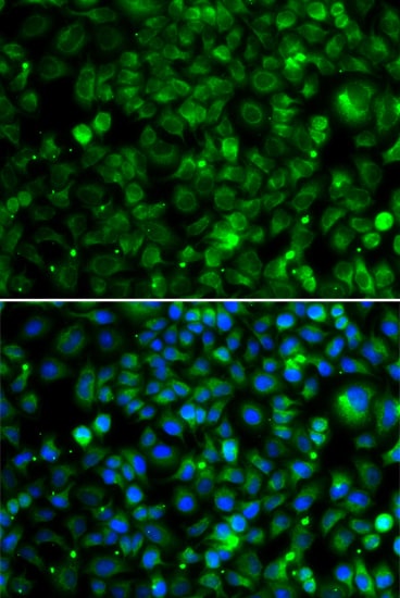 TMLHE Antibody - BSA Free