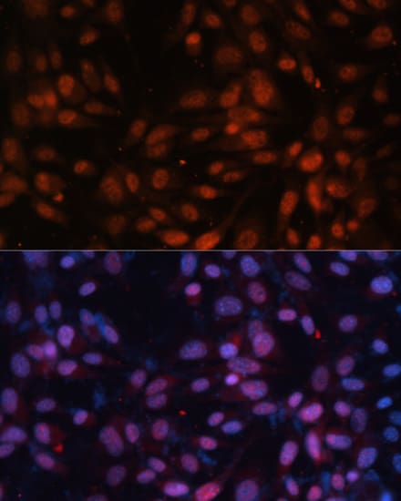 ZNF574 Antibody - Azide and BSA Free