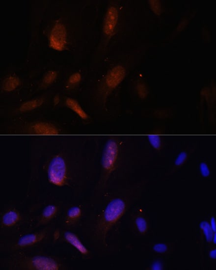 ZNF574 Antibody - Azide and BSA Free