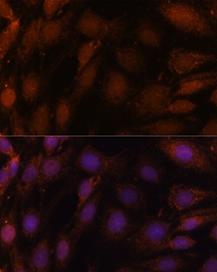 GCAT Antibody - Azide and BSA Free