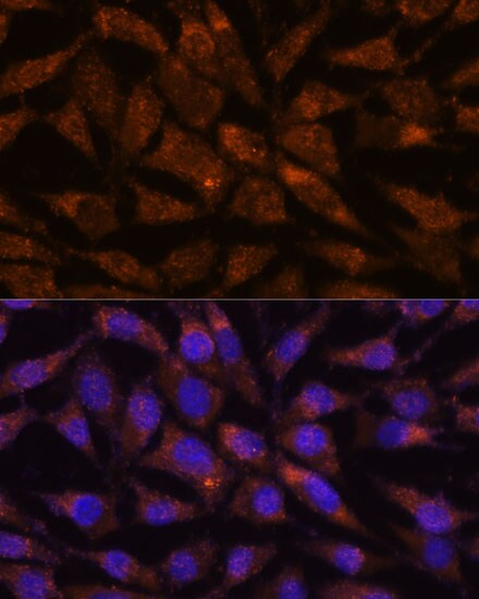 LMAN2 Antibody - Azide and BSA Free