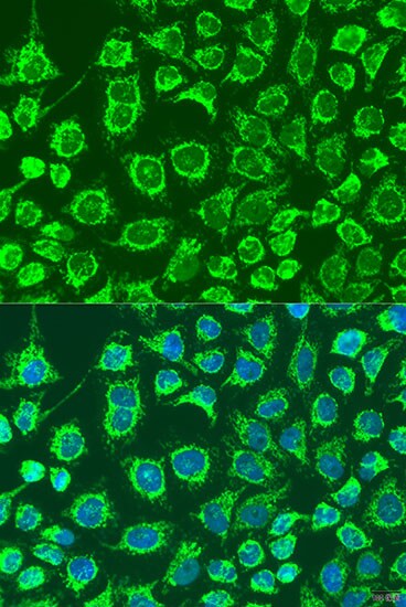 GYPB Antibody - BSA Free