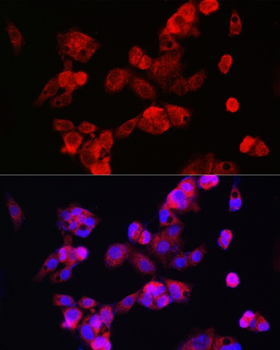 CYP7A1 Antibody - Azide and BSA Free